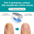 Aparelho Anti-Micose A Laser | A Solução Definitiva para Unhas com Fungos
