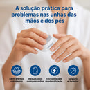 Aparelho Anti-Micose A Laser | A Solução Definitiva para Unhas com Fungos