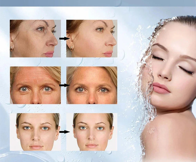 BiocollagenPlus Pro | Máscara Absorvível de Colágeno + Ativos do Botox