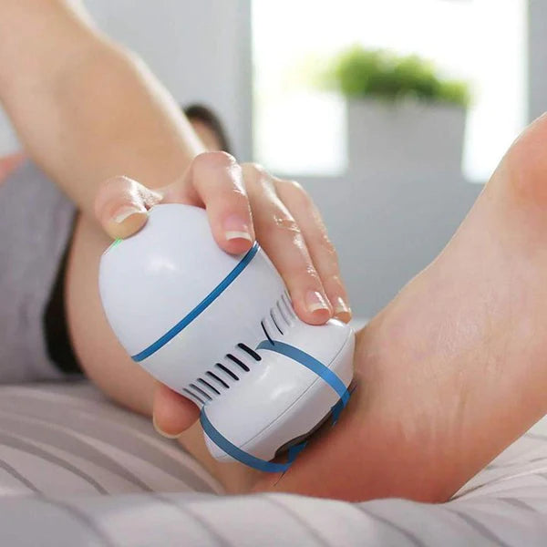 Removedor de Calos e Rachaduras Beauty Feet