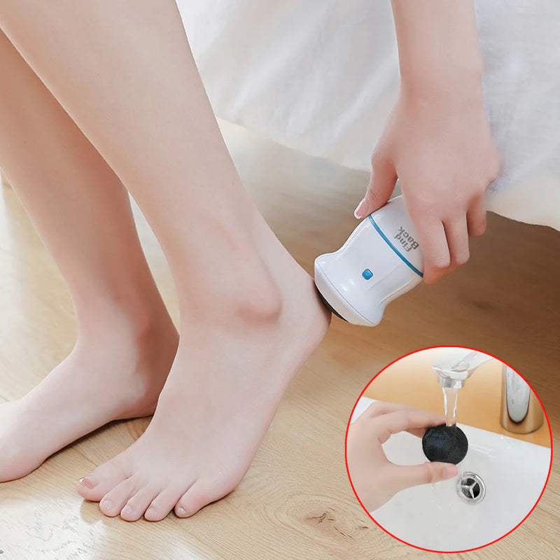 Removedor de Calos e Rachaduras Beauty Feet