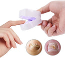 Aparelho Anti-Micose A Laser | A Solução Definitiva para Unhas com Fungos